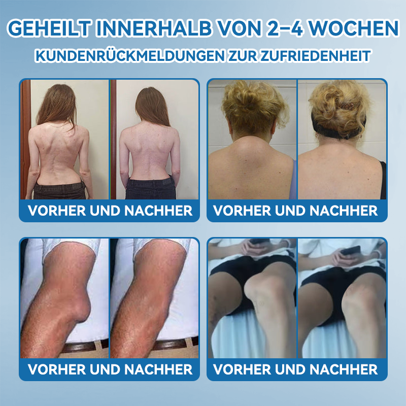 𝖯𝗂𝖼𝗱𝗼® BPC-157 Gelenk-Heilcreme💪Behandelt Arthritis, Neuropathie, Rheuma, Sportverletzungen und mehr👩⚕️