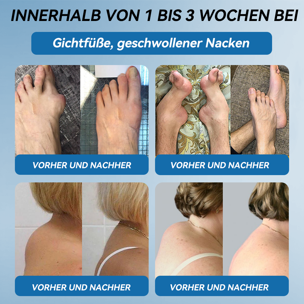 𝖯𝗂𝖼𝗱𝗼® BPC-157 Gelenk-Heilcreme💪Behandelt Arthritis, Neuropathie, Rheuma, Sportverletzungen und mehr👩⚕️