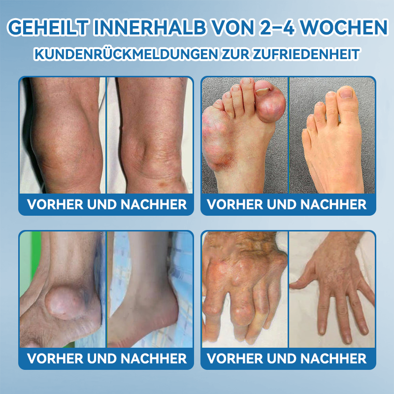 𝖯𝗂𝖼𝗱𝗼® BPC-157 Gelenk-Heilcreme💪Behandelt Arthritis, Neuropathie, Rheuma, Sportverletzungen und mehr👩‍⚕️