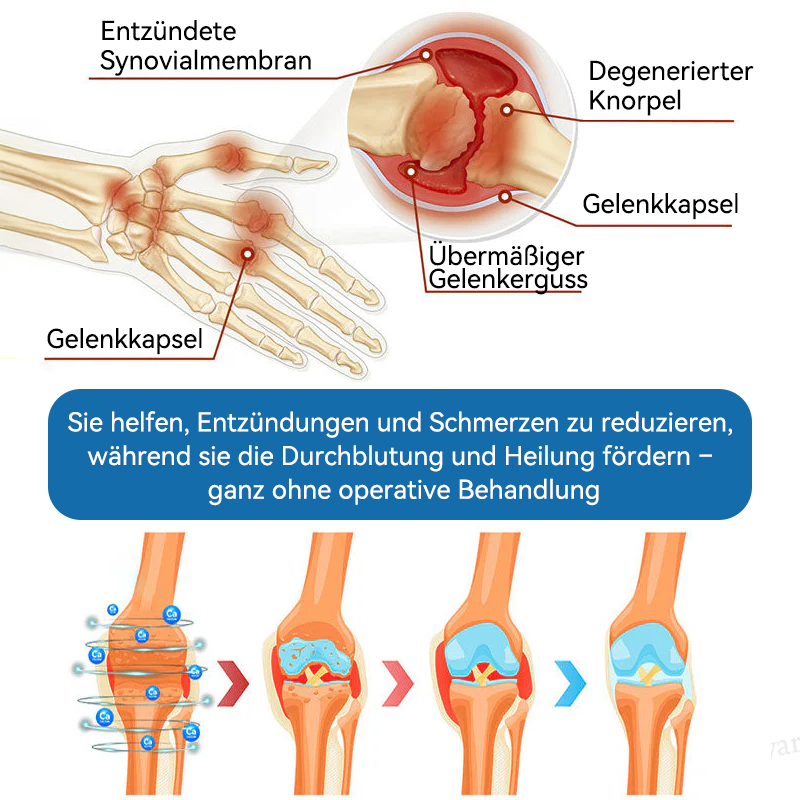 𝖯𝗂𝖼𝗱𝗼® BPC-157 Gelenk-Heilcreme💪Behandelt Arthritis, Neuropathie, Rheuma, Sportverletzungen und mehr👩‍⚕️