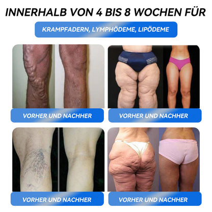 IFMAGIC® GLP-1 Pro Schlankheits-Trinklösung 👀7 Tage sichtbare Wirkung, keine Nebenwirkungen, geeignet für alle Altersgruppen⏰