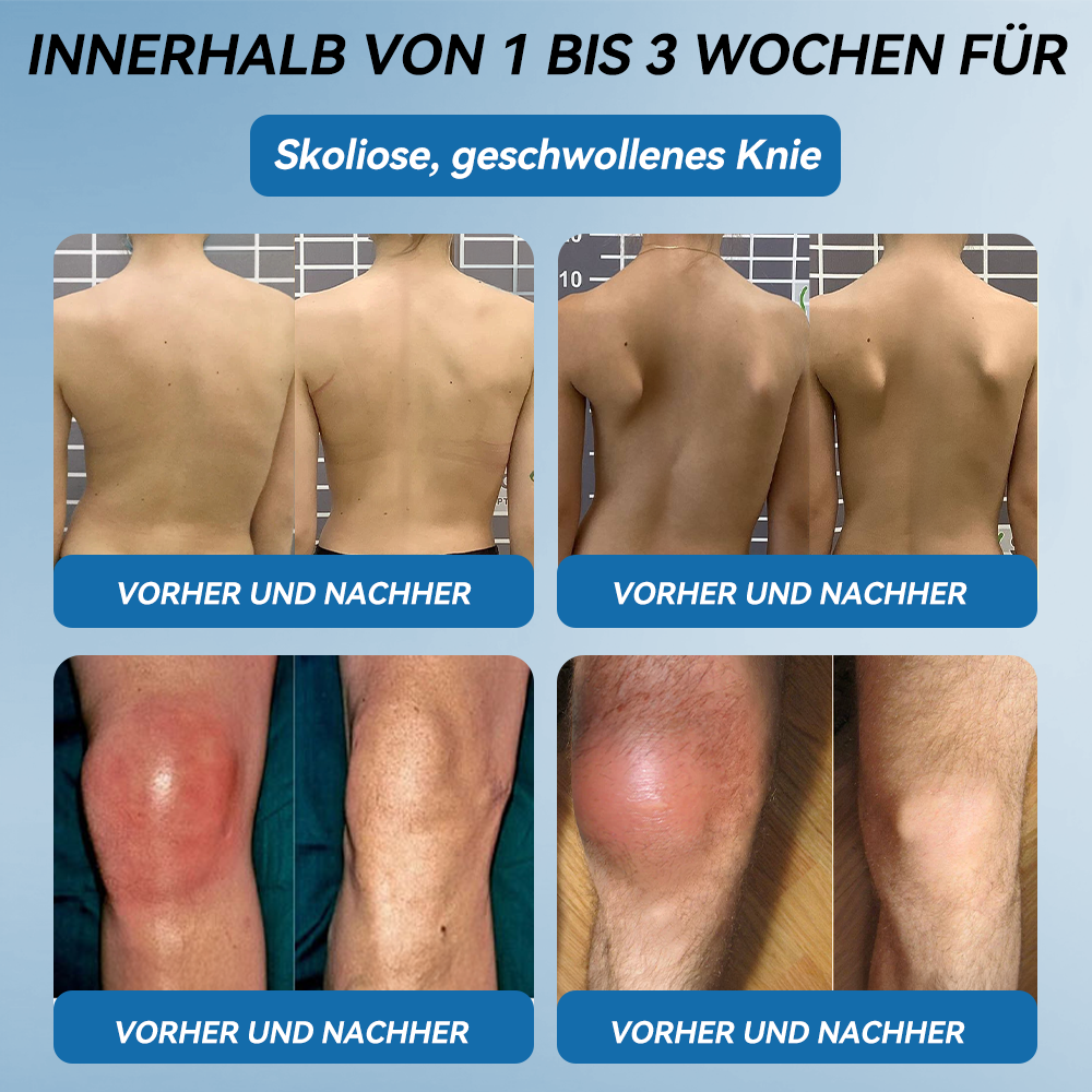𝖯𝗂𝖼𝗱𝗼® BPC-157 Gelenk-Heilcreme💪Behandelt Arthritis, Neuropathie, Rheuma, Sportverletzungen und mehr👩‍⚕️