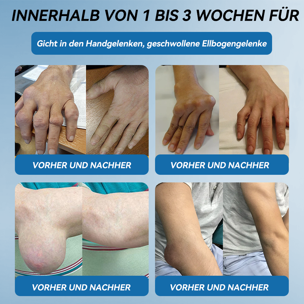 𝖯𝗂𝖼𝗱𝗼® BPC-157 Gelenk-Heilcreme💪Behandelt Arthritis, Neuropathie, Rheuma, Sportverletzungen und mehr👩‍⚕️