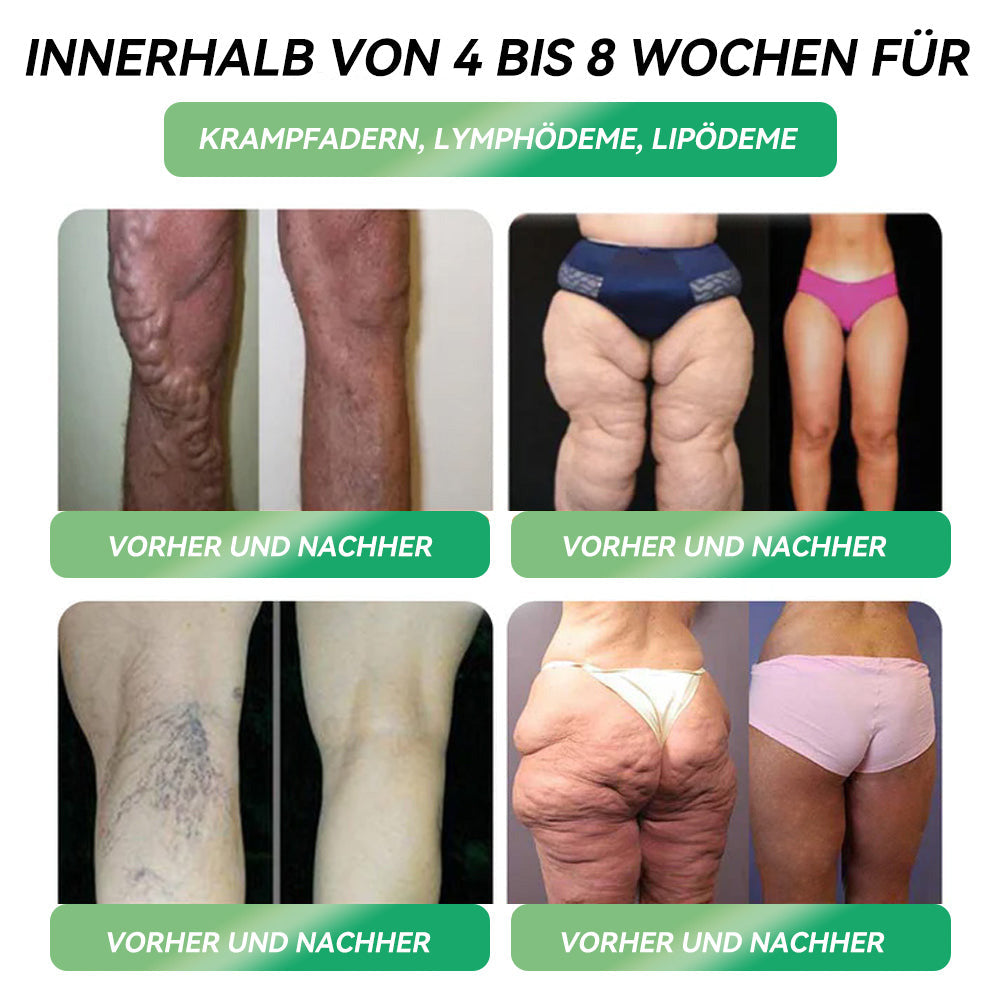 Zertifiziert durch das Swissmedic 🇨🇭 𝑆𝑇𝐷𝐸𝐼®  𝐺𝐿𝑃-1  𝑂𝑟𝑎𝑙𝑒 𝐿ö𝑠𝑢𝑛𝑔 𝑧𝑢𝑟 𝐺𝑒𝑤𝑖𝑐ℎ𝑡𝑠𝑟𝑒𝑑𝑢𝑘𝑡𝑖𝑜𝑛 👀 Geeignet bei Fettleibigkeit, Herz-Kreislauf-Gesundheit, Diabetes, Schlafapnoe, Gelenkproblemen und mehr👨‍🔬